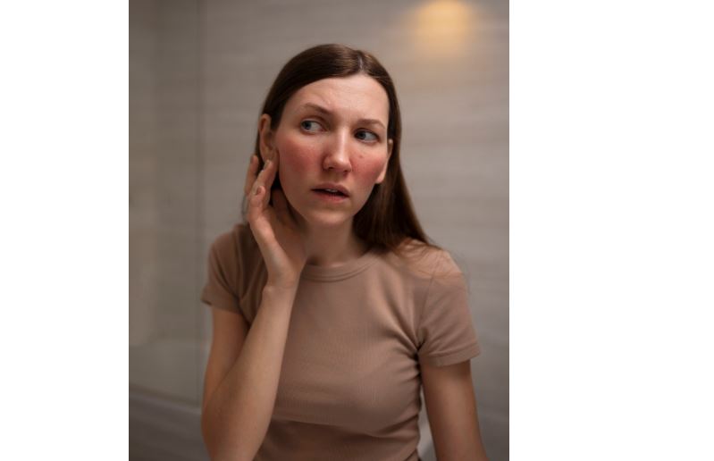 lupus disease